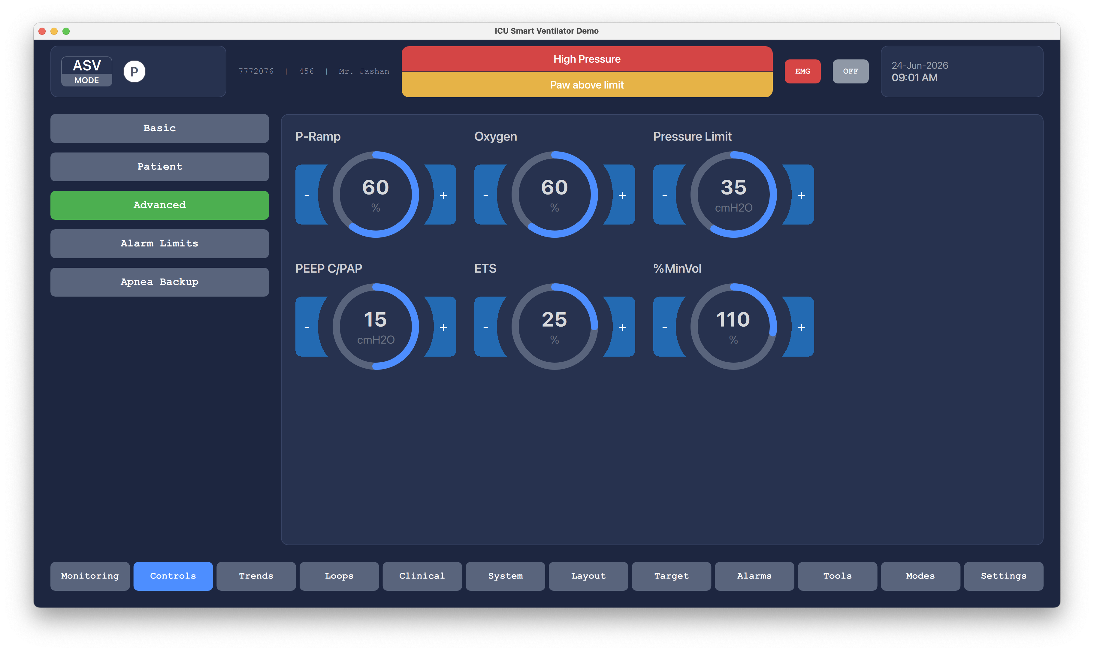 Advanced Ventilation Controls Qt/QML interface screenshot