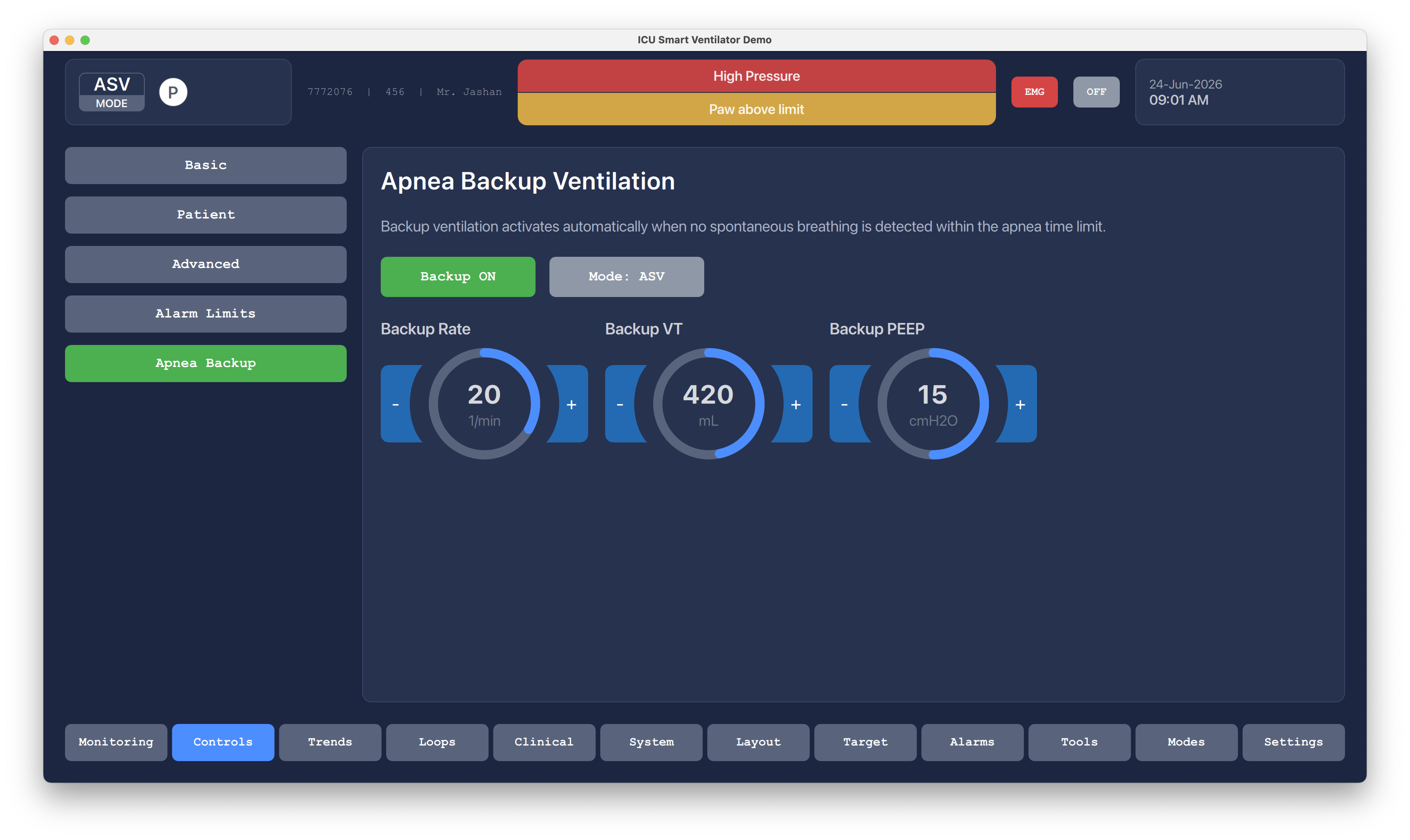 Apnea Backup Ventilation Qt/QML interface screenshot