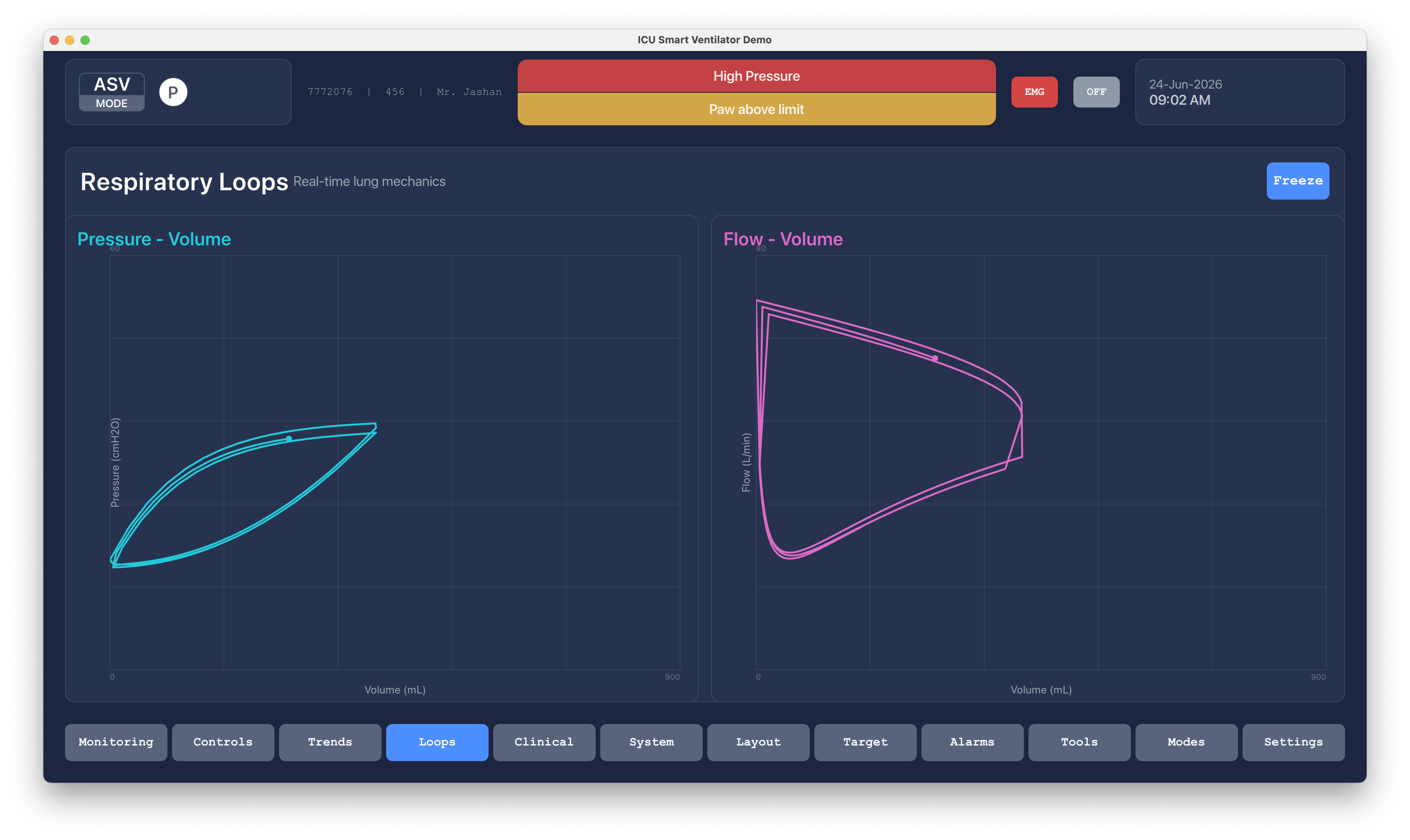 Respiratory Loops Qt/QML interface screenshot