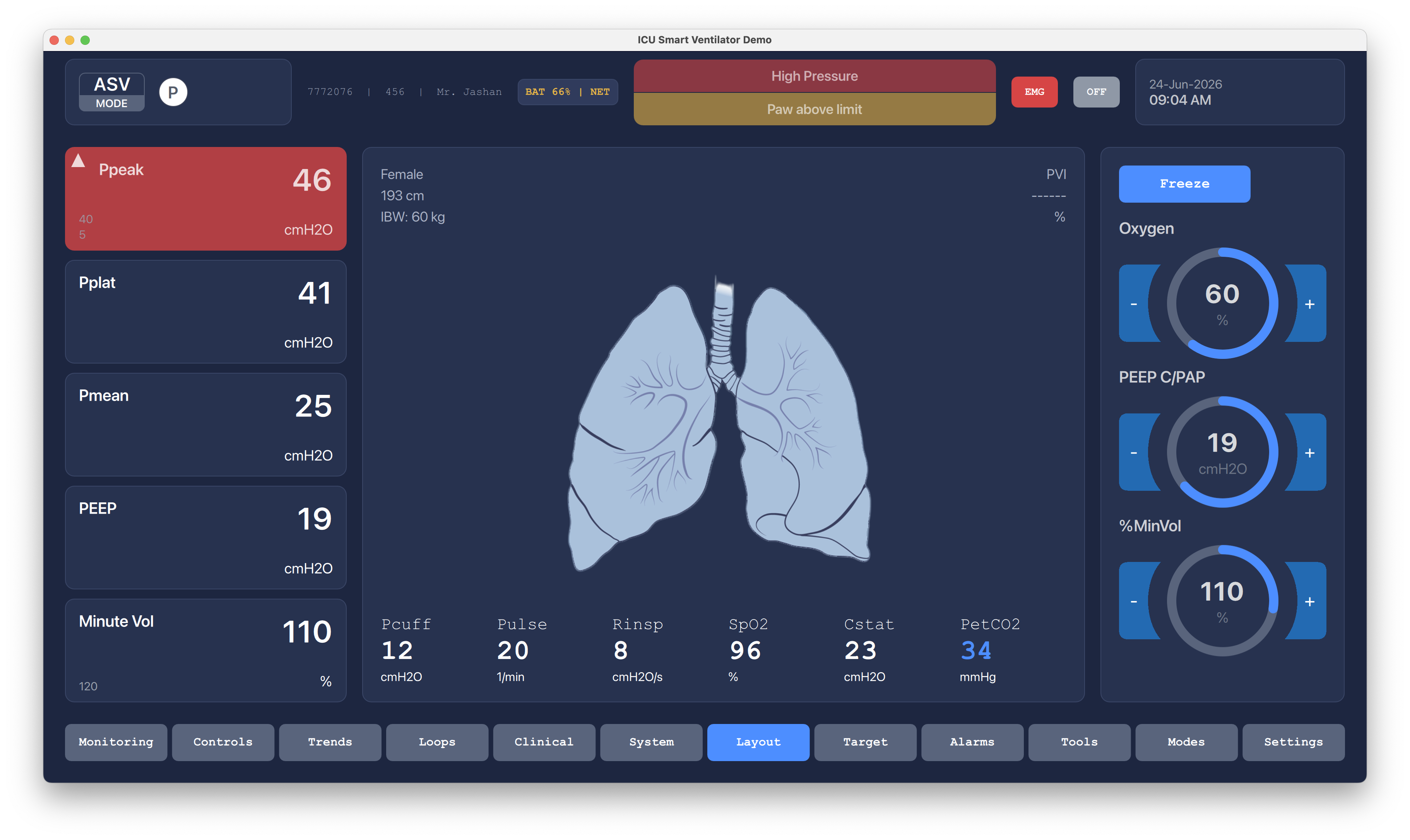 Ventilation Modes Qt/QML interface screenshot