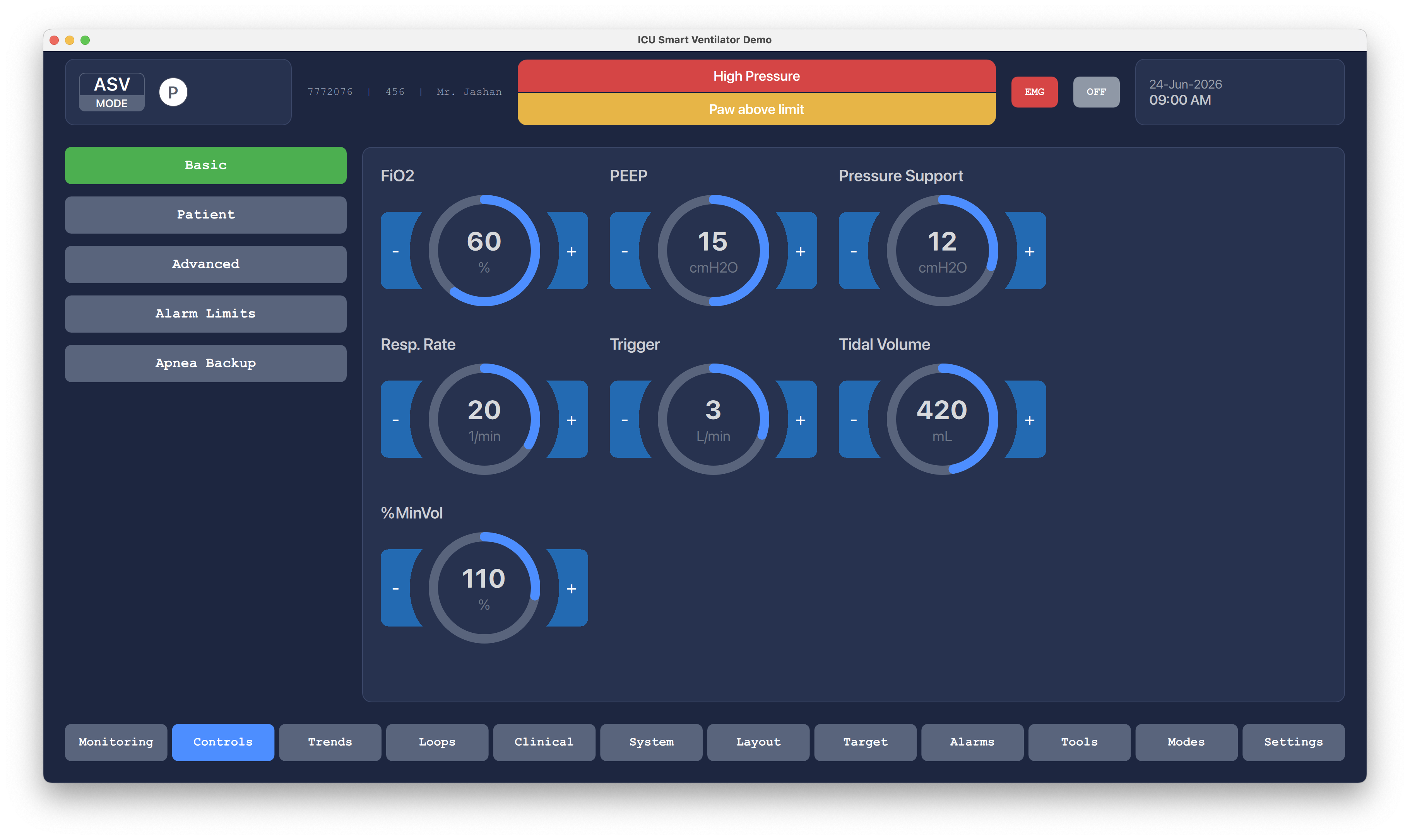 Basic Ventilation Controls Qt/QML interface screenshot